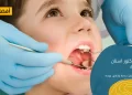 افضل دكتور أسنان في جدة