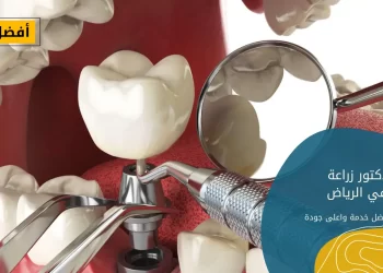 افضل دكتور زراعة اسنان في الرياض